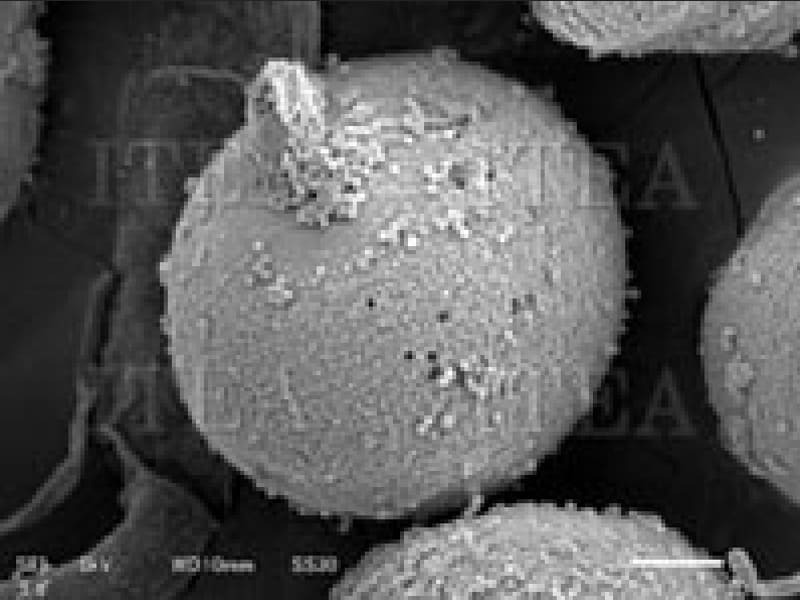 スギ花粉の電子顕微鏡写真。表面の微細な構造もはっきり見える。